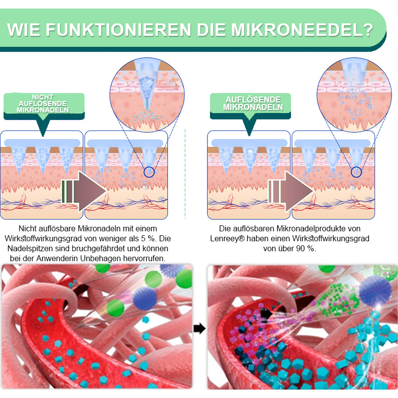 【𝑳𝒆𝒕𝒛𝒕𝒆𝒓 𝑻𝒂𝒈 – 60 % 𝑹𝑨𝑩𝑨𝑻𝑻】𝑳𝒆𝒏𝒓𝒆𝒆𝒚® 𝑵𝑰𝑫𝑫𝑲-𝑻𝒊𝒓𝒛𝒆𝒑𝒂𝒕𝒊𝒅 𝑺𝒄𝒉𝒍𝒂𝒏𝒌𝒉𝒆𝒊𝒕𝒔- & 𝑮𝒆𝒔𝒖𝒏𝒅𝒉𝒆𝒊𝒕𝒔-𝑵𝑨𝑵𝑶-𝑴𝑰𝑲𝑹𝑶𝑵𝑬𝑫𝑬𝑳-𝑷𝑭𝑳𝑨𝑺𝑻𝑬𝑹  (𝑲𝒆𝒊𝒏 𝑺𝒄𝒉𝒎𝒆𝒓𝒛, 24/7 𝑾𝒊𝒓𝒌𝒔𝒕𝒐𝒇𝒇𝒇𝒓𝒆𝒊𝒔𝒆𝒕𝒛𝒖𝒏𝒈 | 𝑺𝒄𝒉𝒏𝒆𝒍𝒍 9 𝒌𝒈 𝒗𝒆𝒓𝒍𝒊𝒆𝒓𝒆𝒏 | 90 % 𝑩𝒍𝒖𝒕𝒛𝒖𝒄𝒌𝒆𝒓𝒔𝒆𝒏𝒌𝒖𝒏𝒈)🌞